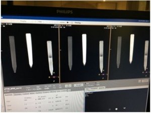 PAÜ Öğrencileri MRCP’de görüntü kalitesini artıran yüzde 100 doğal ürün tasarladı