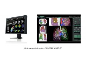 Görüntü analiz sistemine büyük ödül