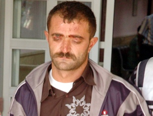 Tek kollu sürücü kaza yaptı