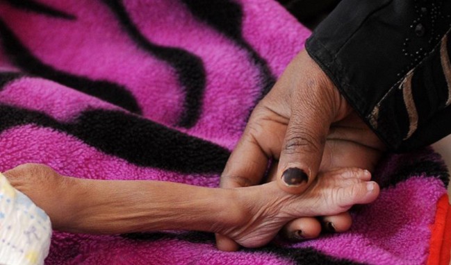 Yaprakları yiyerek hayatta kalmaya çalışıyorlar!