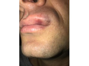Hakeme kafa atan futbolcuya 20 maç ceza