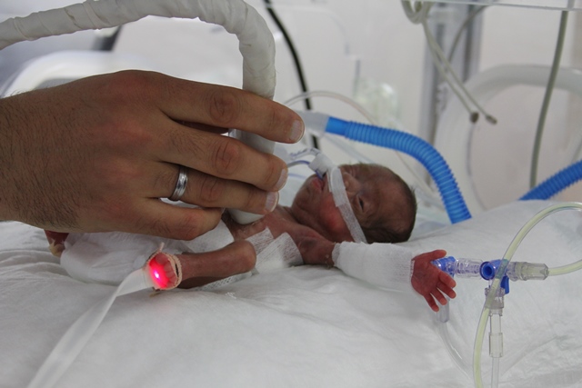 514 gram doğan bebeğe "hayat" operasyonu