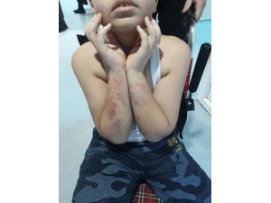Uşak’ta engelli çocuğa darp iddiası