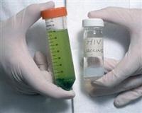 ABD'nin başı AIDS'le dertte