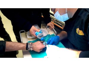 Şişen parmaklarında sıkışan yüzükleri itfaiye keserek çıkartabildi