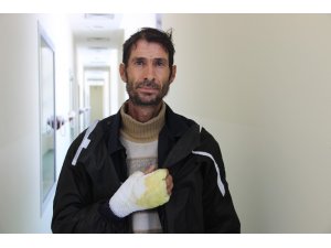 Liseli kız bitlenen saçlarını benzinle yıkamak isterken kendini yaktı (2)