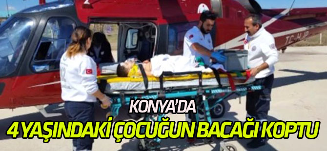 Otomobilden Düşüp Bariyere Çarpan 4 Yaşındaki Çocuğun Bacağı Koptu