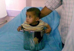 Esma tencereye sıkışınca