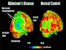 Göz kusurlarına son