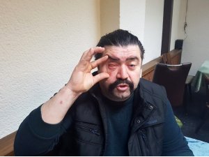Asker uğurlamasında terör estiren şahıslar tartıştıkları adamın gözünü çıkardı