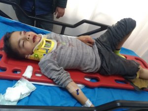 Okulda mazgalla birlikte boşluğa düşen çocuk yaralandı