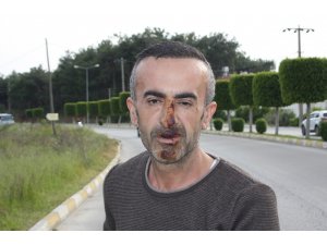 Yağmurdan kaçarken doluya tutuldular