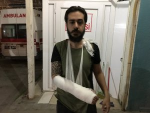 Kendisine saldıran köpekten kaçarken düştü, kolu kırıldı