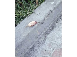 Caddede oyun oynarken kesik parmak buldular
