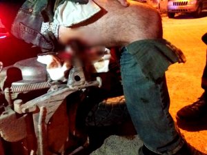 Doktorlarda şok oldu: Motosikletin ayaklığı bacağına saplandı