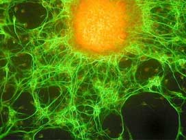 Kanser hücresini yok eden enzim bulundu