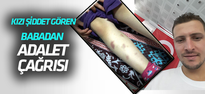 Kızı şiddet gören babadan  Adalet çağrısı