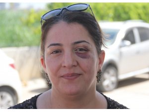 Yaralıya müdahale eden hemşire bu hale getirildi