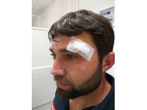 Ambulans sürücüsü darp edildi