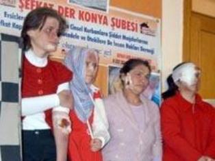 Kadınlar eşlerinden neden dayak yer