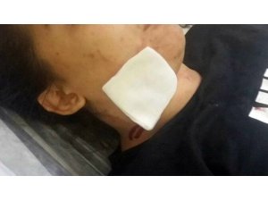 Çenesinden girip şah damarının yanından çıktı