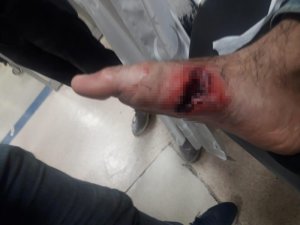 Yılan yerine ayağına sıktı