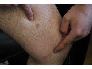 Boşanmak isteyince kayınpederi tarafından silahla vuruldu