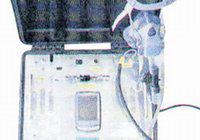 Bu makine kanseri kokluyor