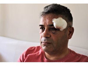 İYİ Parti grup başkan vekili trafikte 4 kişinin saldırısına uğradı