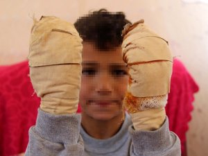 Komşu çocuğu, küçük Efe’ye dehşeti yaşattı