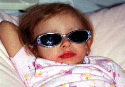 Gözdeki siyah beneklere dikkat!