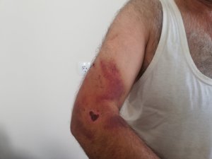 Engelli kız ve babasına ‘Bana niye oy vermedin’ dayağı