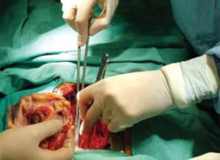 Organ bağışında yeterli değiliz ama umut var