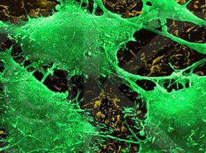 Kanser hastaları için yeni umut