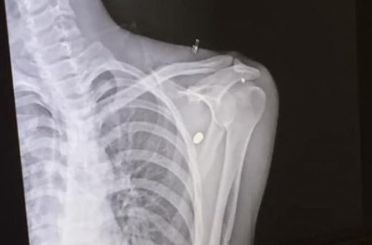 Konya’da kaldırımda yürüyen gencin omzuna mermi isabet etti