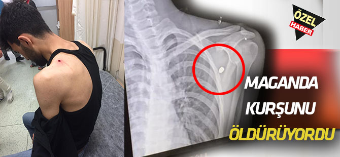 Maganda kurşunu ölümüne neden oluyordu