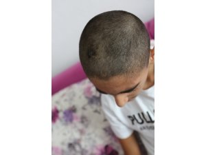 Maganda kurşunuyla yaralanan Efe'nin okul özlemi