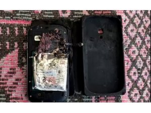 Patlayan cep telefonu bacağını parçaladı
