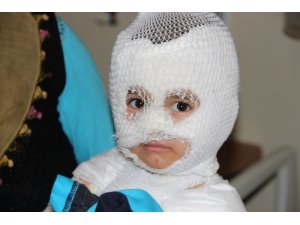 Isıtıcıdaki kaynar su üzerine dökülen çocuk ölümden döndü