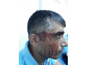 Osmaniye cezaevinde mahkum, bardakla 3 gardiyanı yaraladı