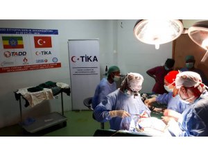 Türk doktorlar Etiyopya'da birbirinden zorlu ameliyatlar gerçekleştirdi