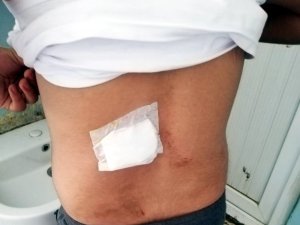 Damda uyuyan genç kanlar içerisinde uyandı