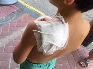 Antalya’da ilkokul öğrencisi, okul dönüşü sokak kopeğinin saldırısına uğradı