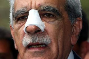 Türk'e yumruklu saldırıda karar