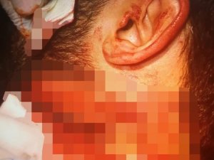 Doktoru boğazından jiletle yaralayan zanlı tutuklandı