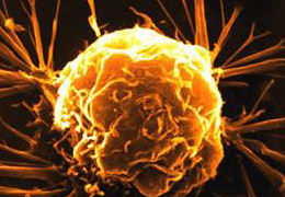 İşte kanserin en büyük nedeni