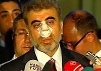 Bakan Yıldız sert konuştu !