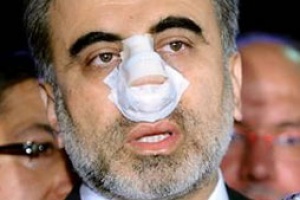 Bakan'a yumruğa 'oh olsun' dedi