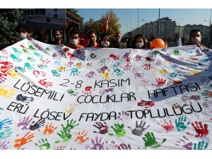 Lösemi hastalarına "maskeli" destek
