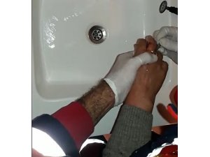 Parmağında sıkışan yüzüğü itfaiye çıkardı
